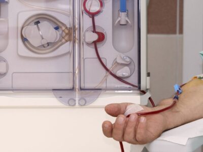 how does dialysis work
